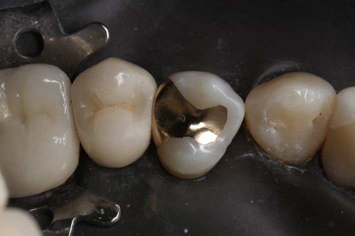 57Bryan Sato #12 finish