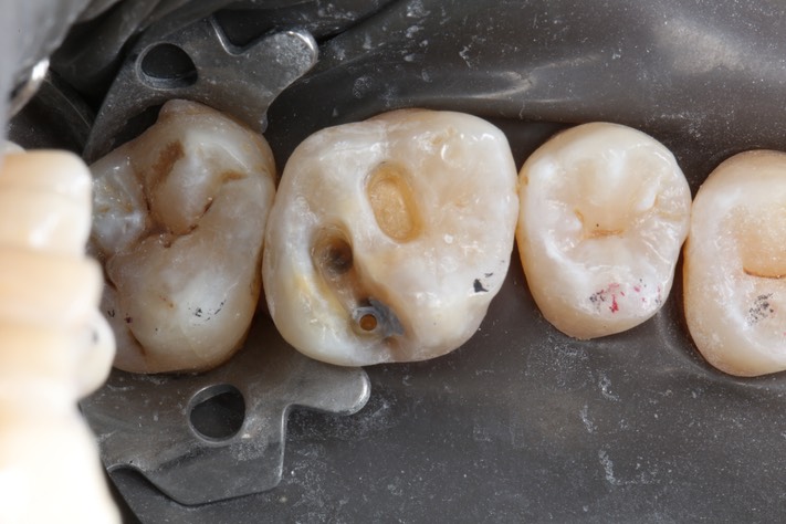 6Kyle Chock #14 prep