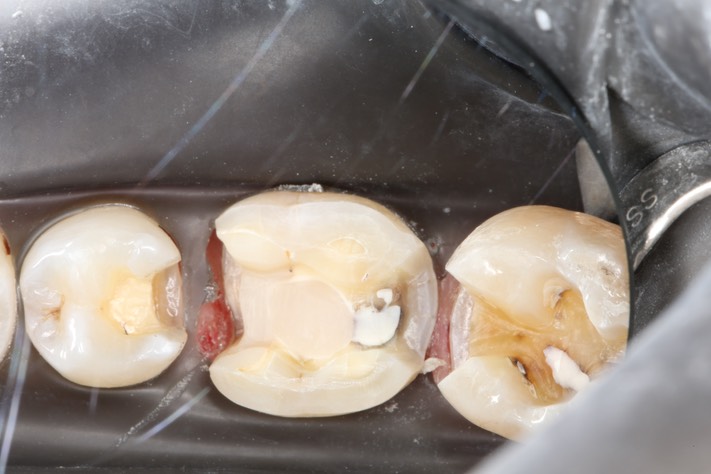 79Gary Umeda #18, 19, 20 prep