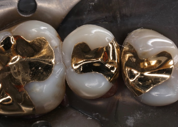 Alan Chinn #13 finish