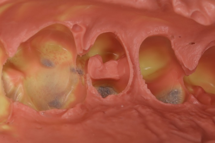 Alan Chinn #13 impression