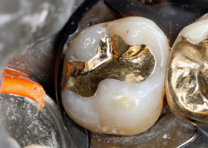 Alan Chinn #15 finish