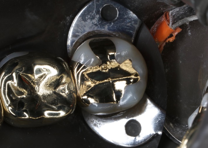 Alan Chinn #17 finish