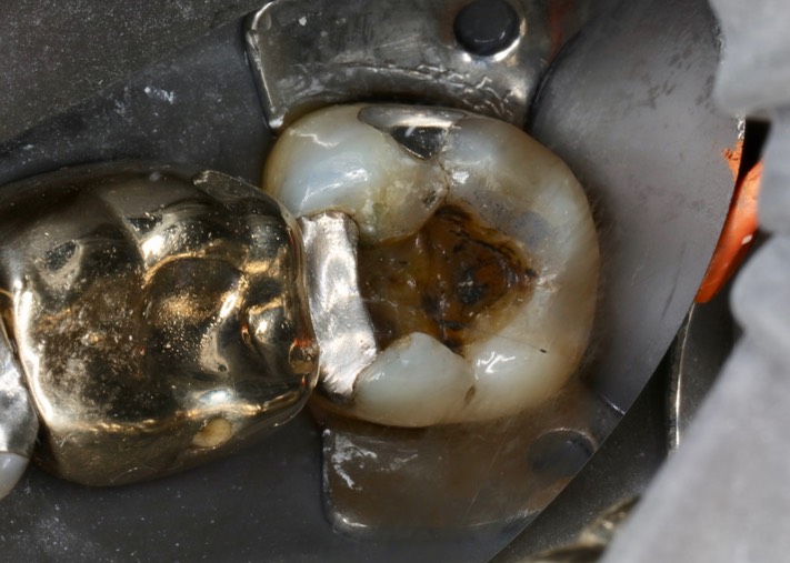 Alan Chinn #18 pre-op