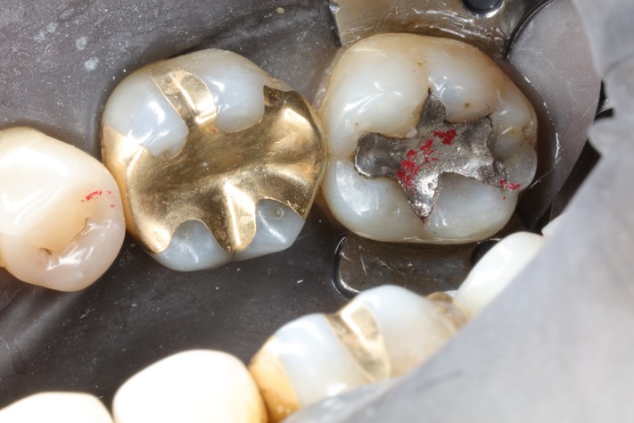 Alan Chinn #18 pre-op