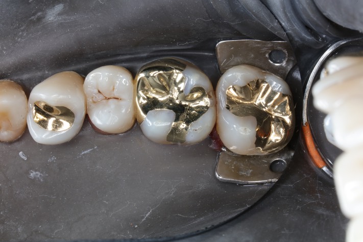 Alan Chinn #2 - 5 finish