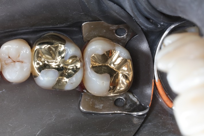 Alan Chinn #2 finish