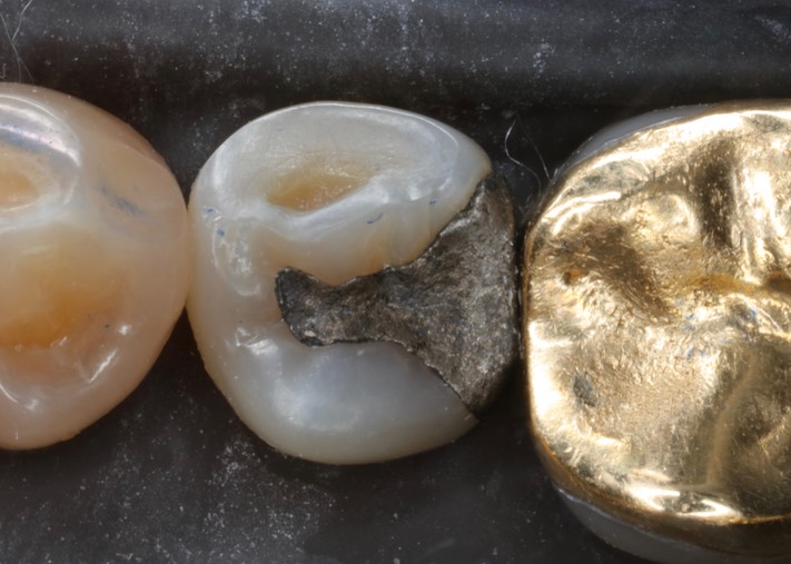 Alan Chinn #20 pre-op