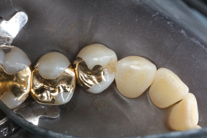 Alan Chinn #28 finish