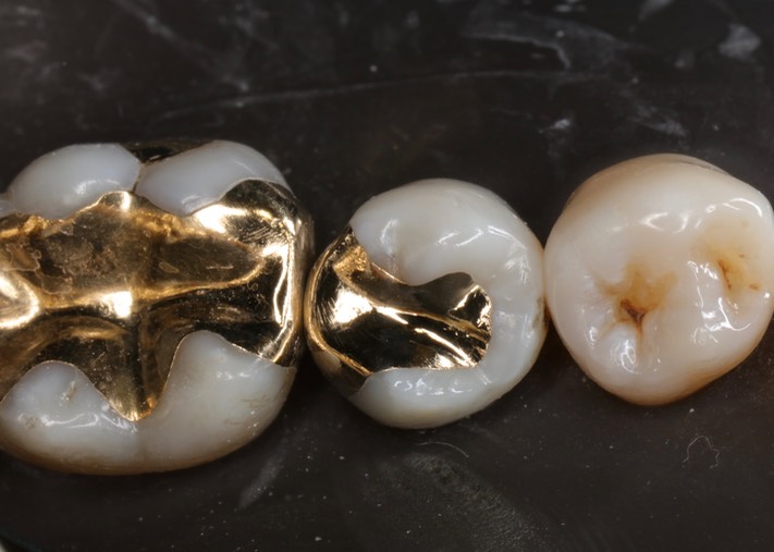 Alan Chinn #29 finish