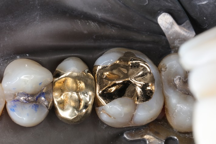 Alan Chinn #3 finish