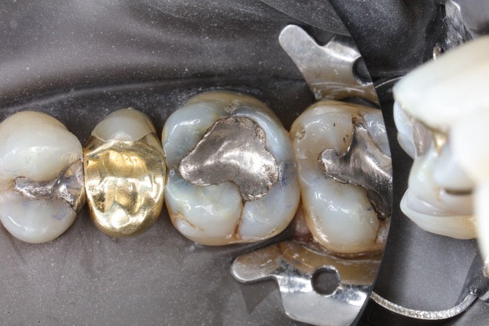 Alan Chinn #3 pre-op