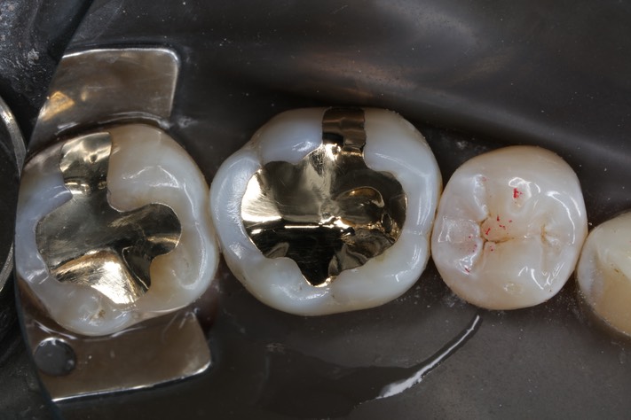 Alan Chinn #30 finish