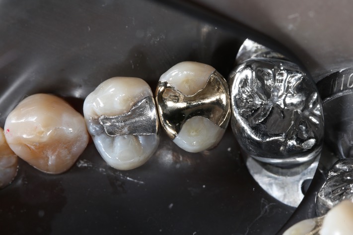 Alan Tamashiro #4 finish