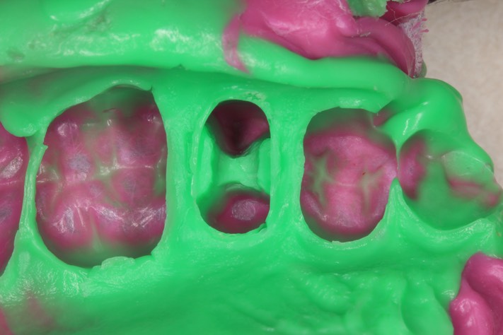 Alan Chinn #13 impression