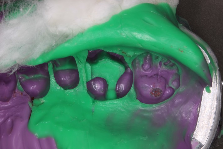 Alan Tamashiro #3 impression