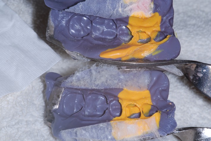 Brandon Yokota #21 impression comparison