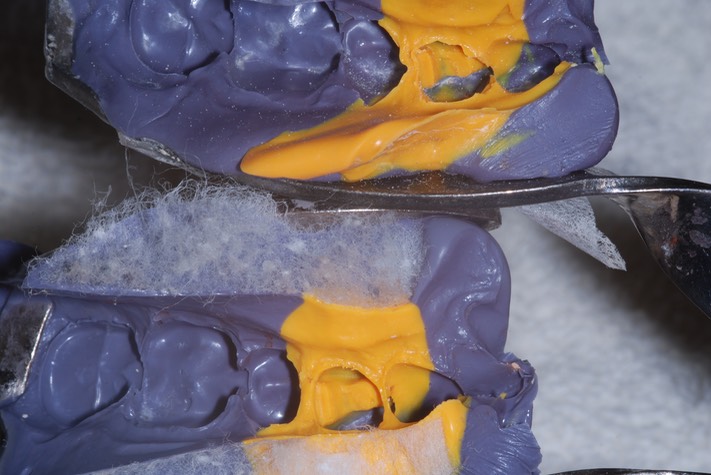 Brandon Yokota #21 impression comparison