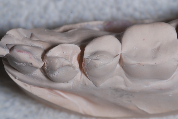 Brandon Yokota #21 model