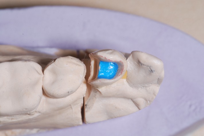 Brandon Yokota #21 model