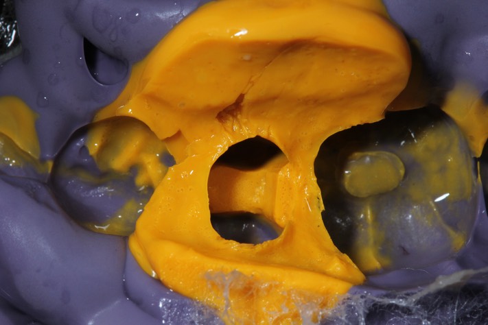 Brandon Yokota impression