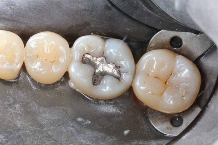 Brian Sato #19 pre-op