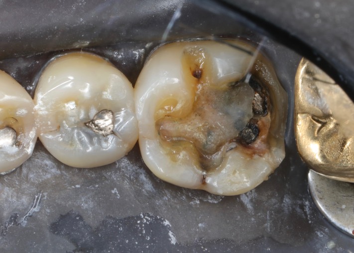 Brian Sato #19 pre-op