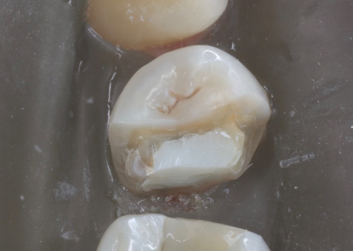 Brian Sato #20 prep 2