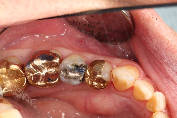 Brian Sato #29 pre-op