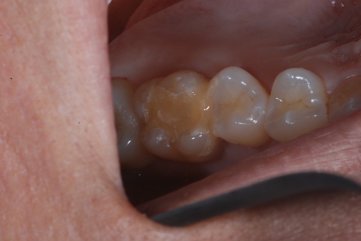 Brian Sato #3 temporary