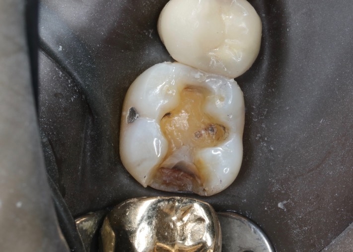 Brian Sato #30 temporary off