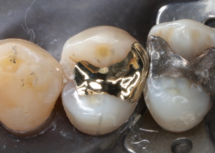 Brian Sato #5  finish