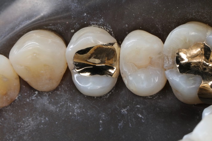 Brian Sato #5 finish