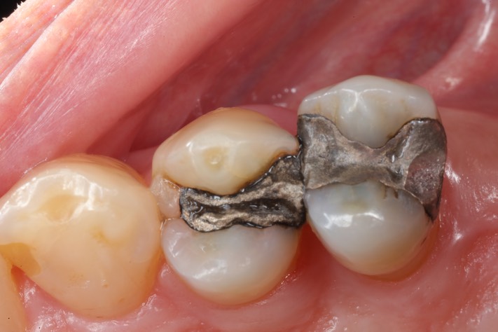 Brian Sato #5 pre-op