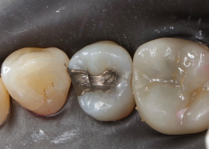 Brian Sato #5 pre-op