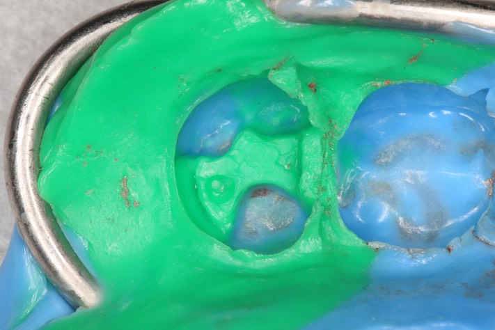 Brian Sato #15 impression