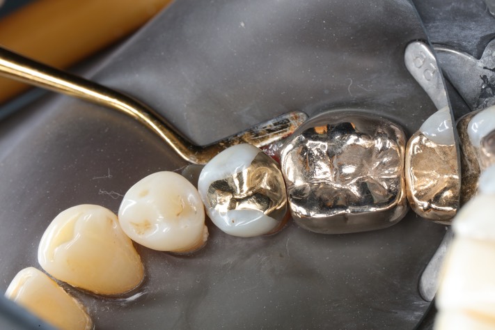 Bryan Sato #20 finish