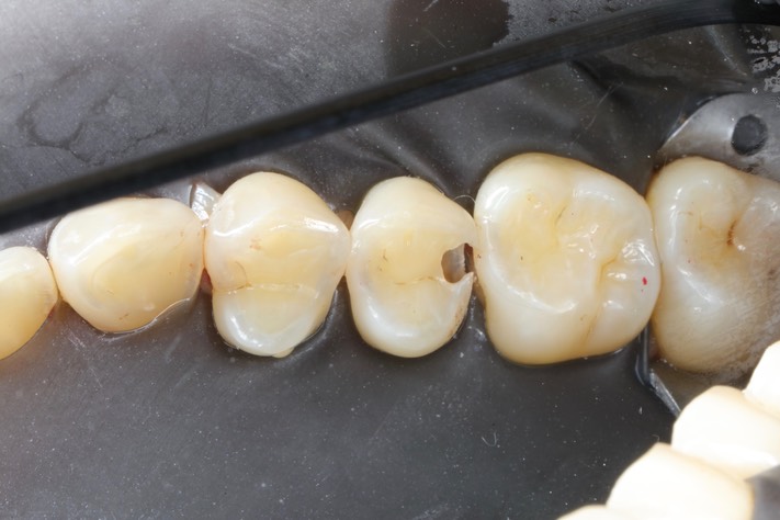 Bryan Sato #4 pre-op