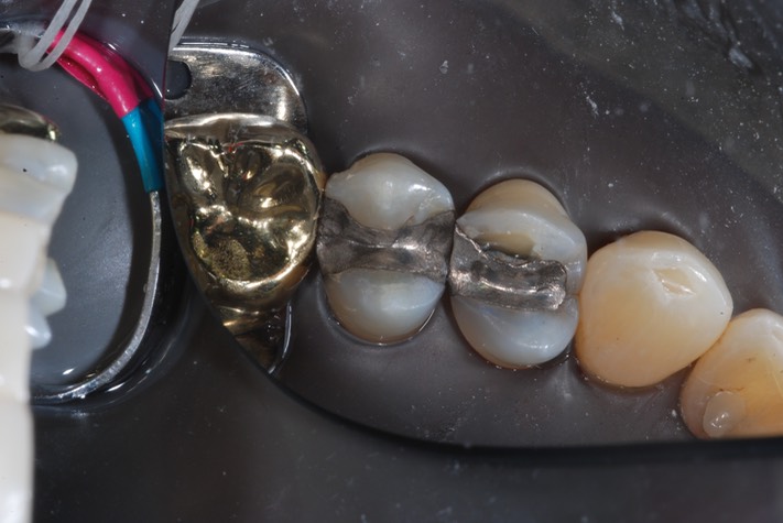 Carla Fukumoto #13 pre-op