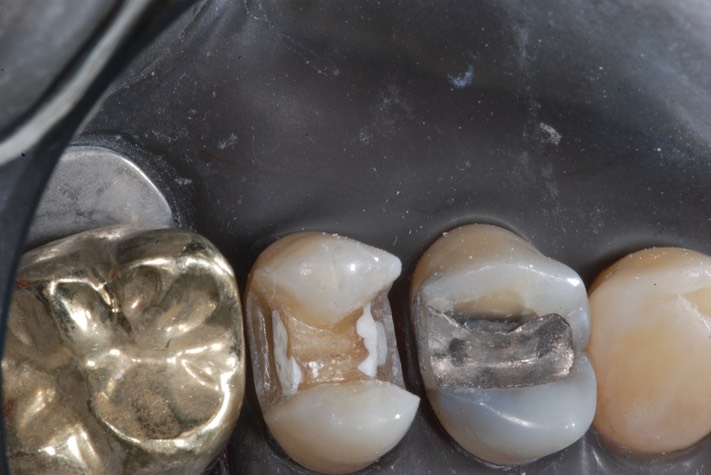 Carla Fukumoto #13 prep