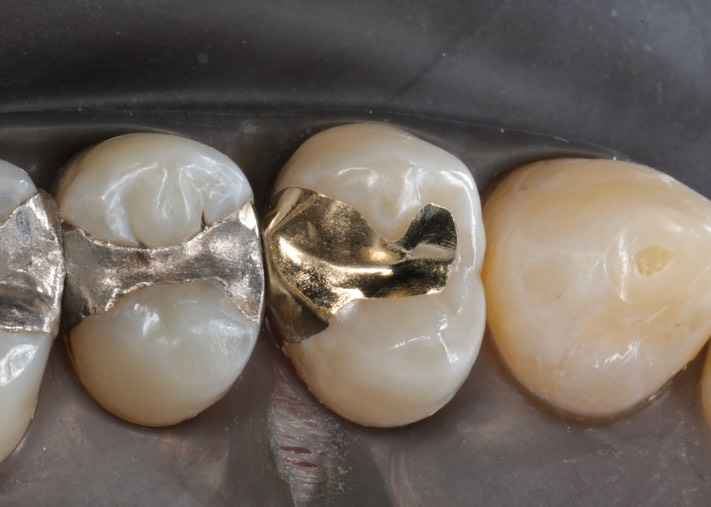 Chris Woo #12 finish