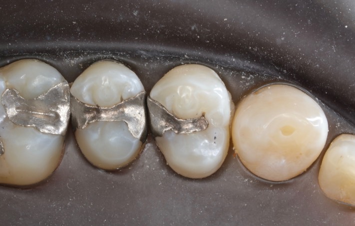 Chris Woo #12 pre-op