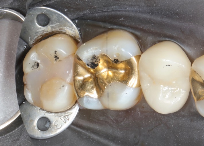 Chris Woo #15 pre-op