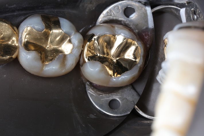 Chris Woo #18 finish