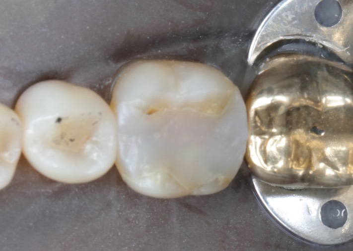 Chris Woo #19 pre-op