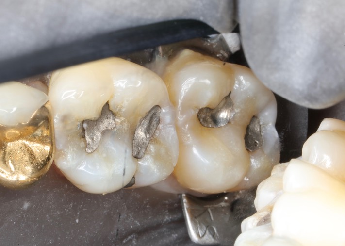 Chris Woo #2 & 3 pre-op