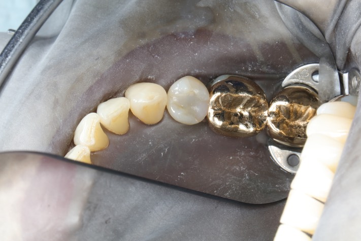 Chris Woo #20 pre-op