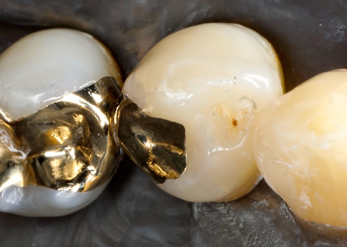 Chris Woo #28 finish