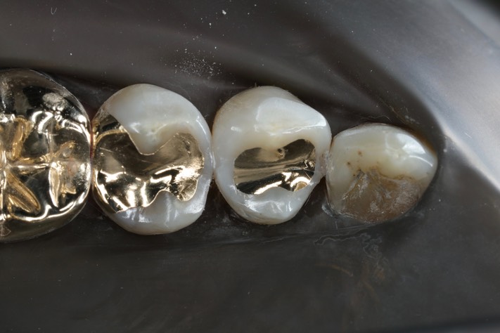 Chris Woo #28 finish