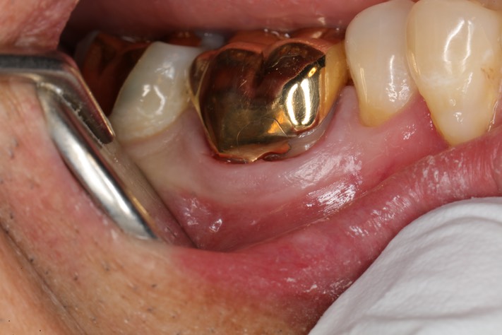 Chris Woo #30 finish